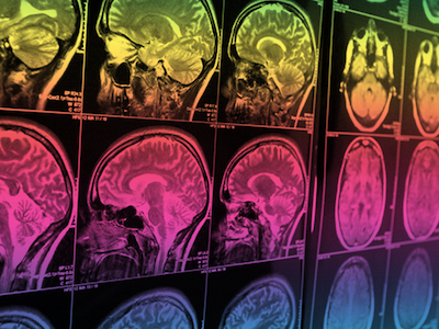 Brain imaging
