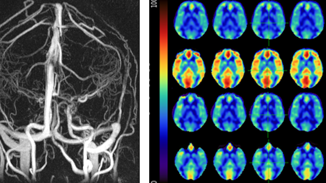 Schrage blood flow research